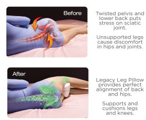 Uporedni prikaz položaja kičme pre i posle korišćenja ortopedskog jastuka za noge